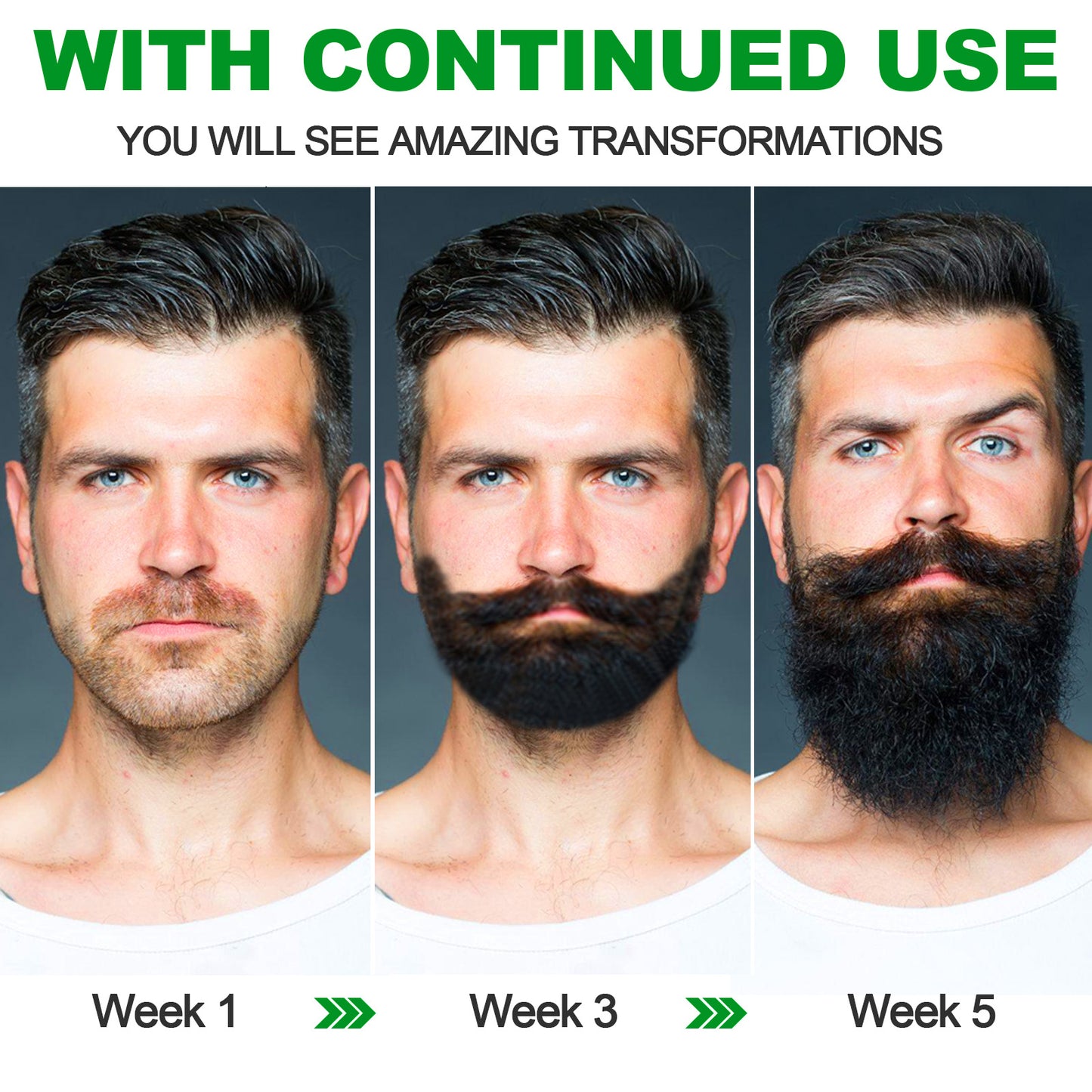 2X Concentration Biotin Beard Growth Oil